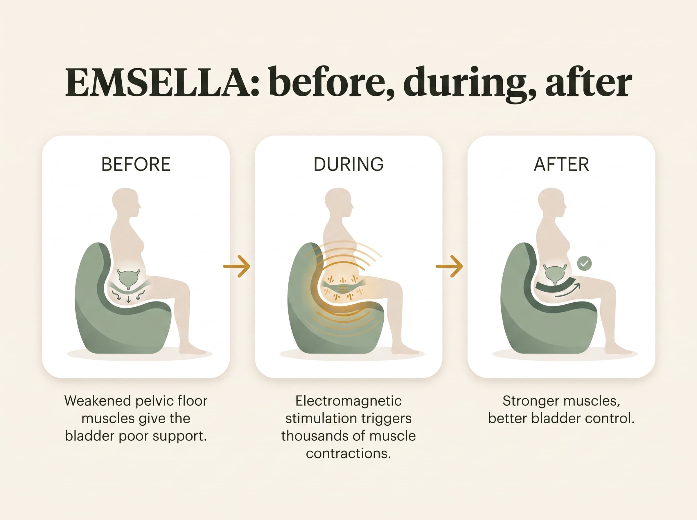 Three-step diagram: before treatment, weakened pelvic floor muscles; during, electromagnetic stimulation contracts them; after, bladder support and control are restored